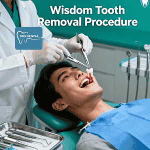 Wisdom Tooth Removal in Hayathnagar