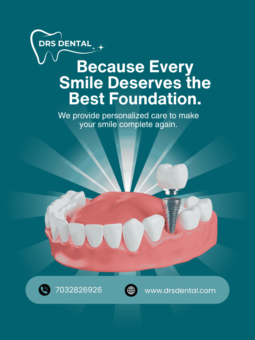 Single tooth implant in Hayathnagar