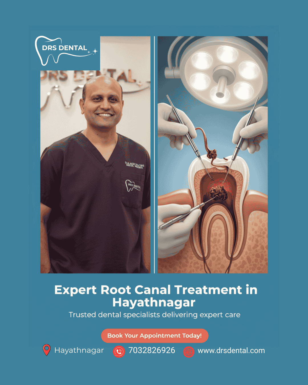 root canal treatment in hayathnagar