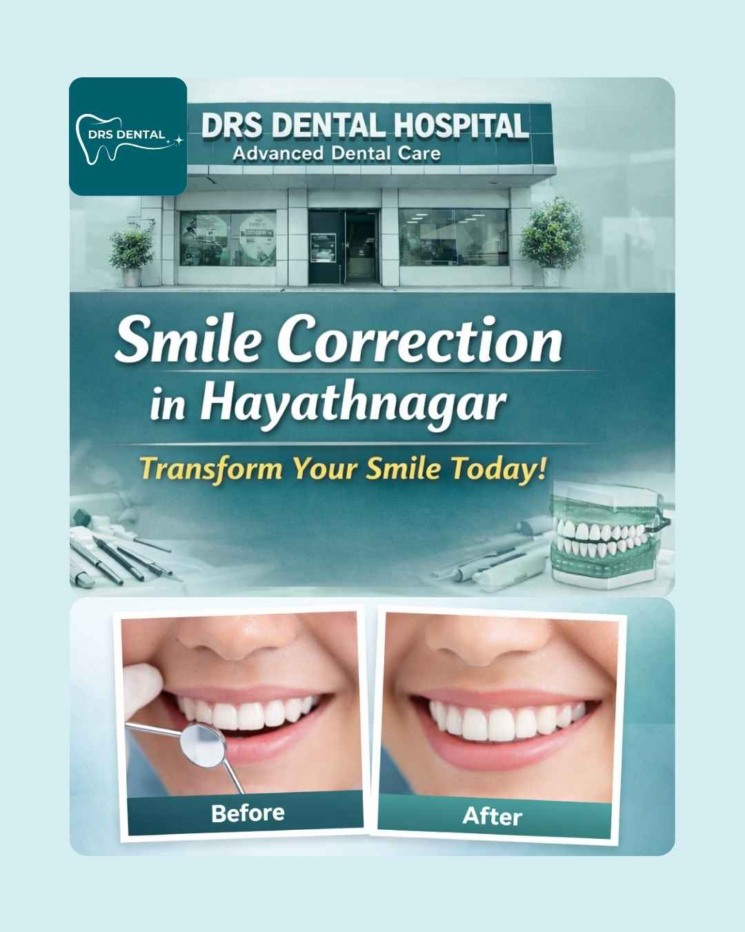 smile correction in Hayathnagar