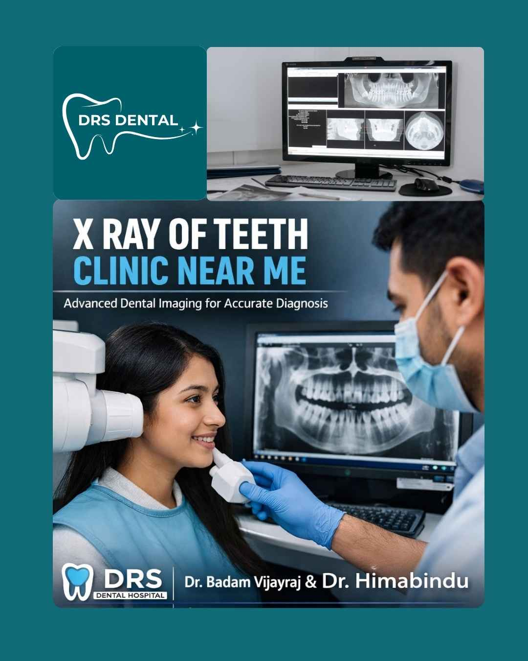 X Ray of Teeth Clinic Near Me